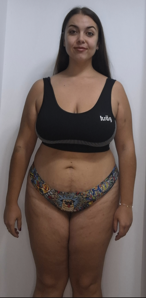 Carmen antes de iniciar su proceso